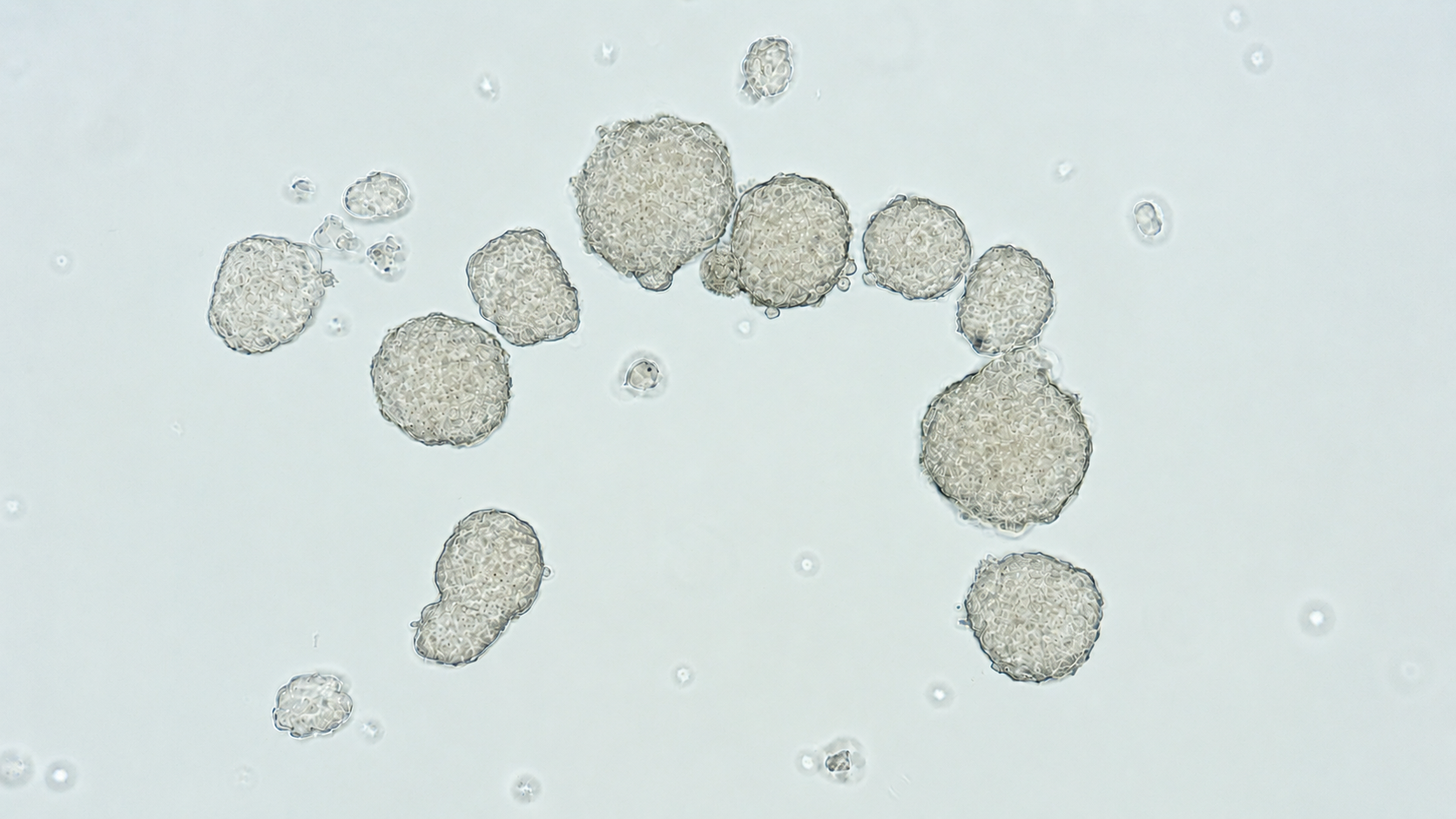 Brightfield microscopy of pancreatic cancer tumor spheres